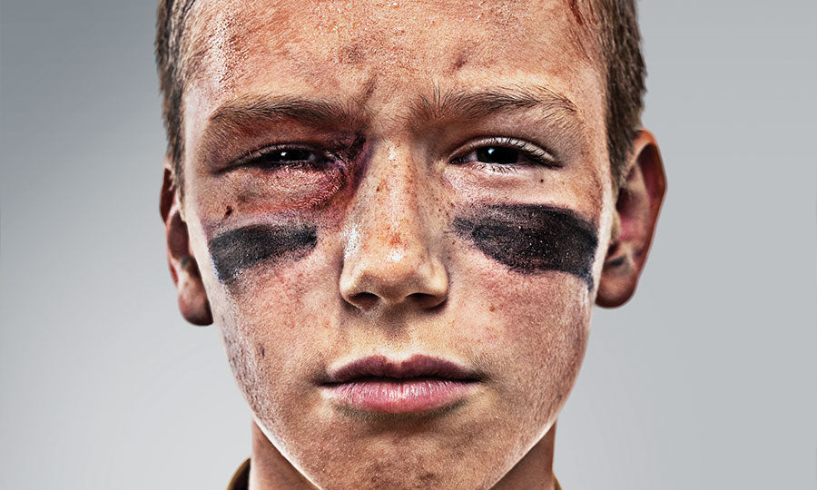 Basketball is the Leading Cause of Eye Injuries - American Academy of  Ophthalmology